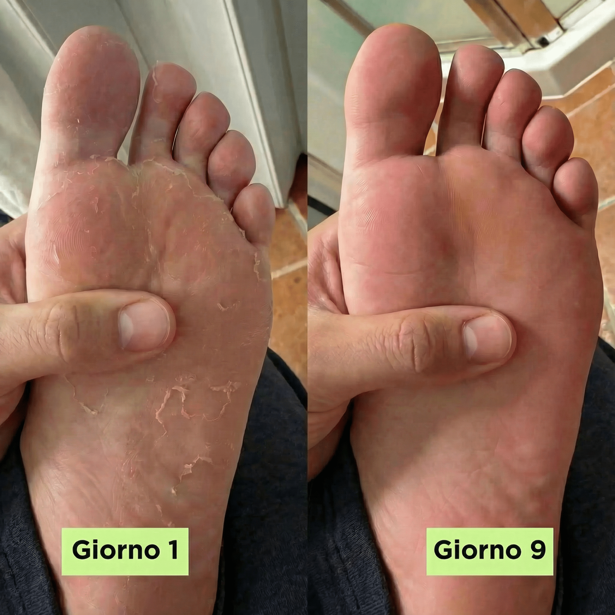 Sapone Anti - Micosi Verdoria - VERDORIA