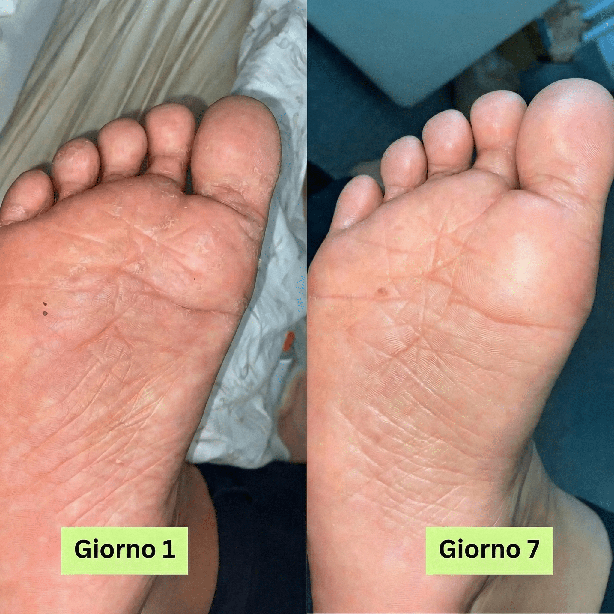 Sapone Anti - Micosi Verdoria - VERDORIA