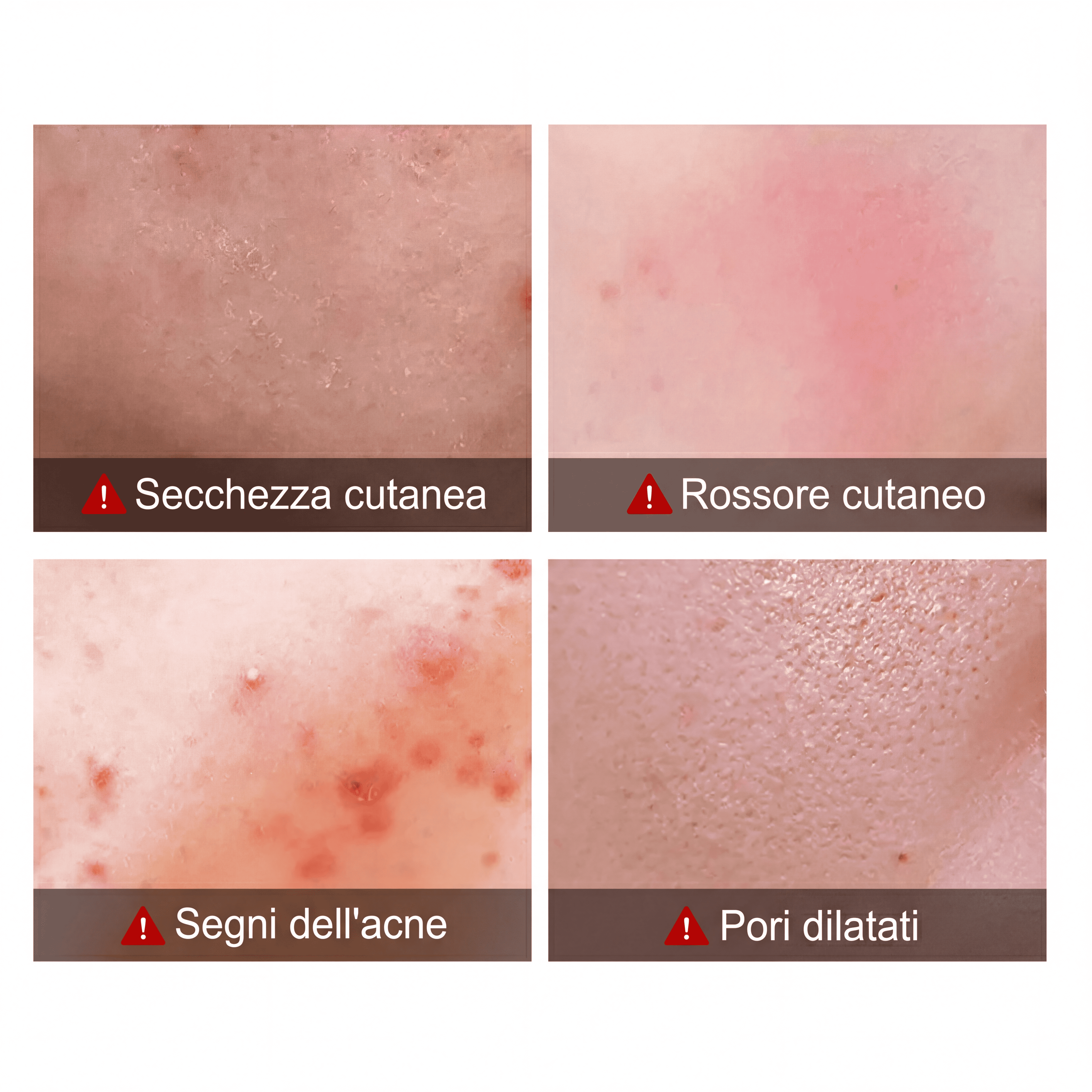 Crema All'olio Di Melaleuca - VERDORIA